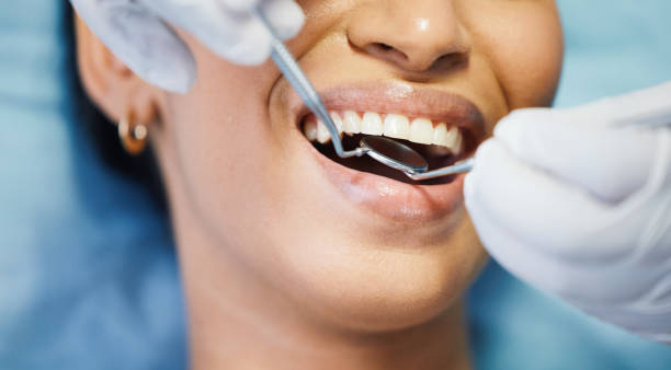 Best Emergency Dental Care for Sports Injuries in Taylorsville, UT